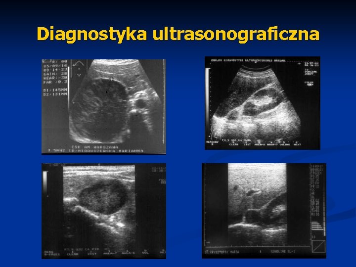 Diagnostyka ultrasonograficzna 