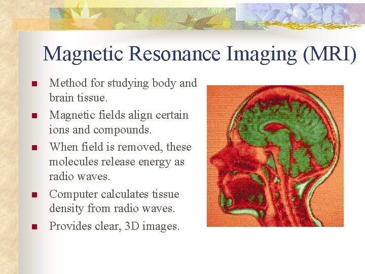 Magnetic Resonance Imaging (MRI) n n n Method for studying body and brain tissue.