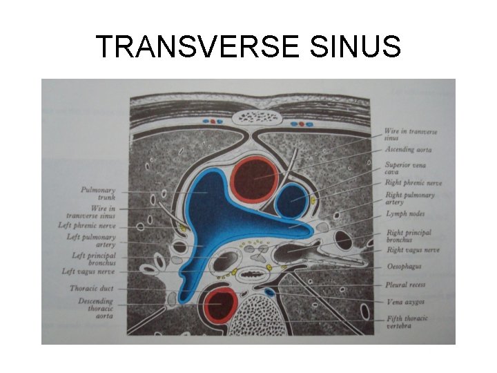 TRANSVERSE SINUS 