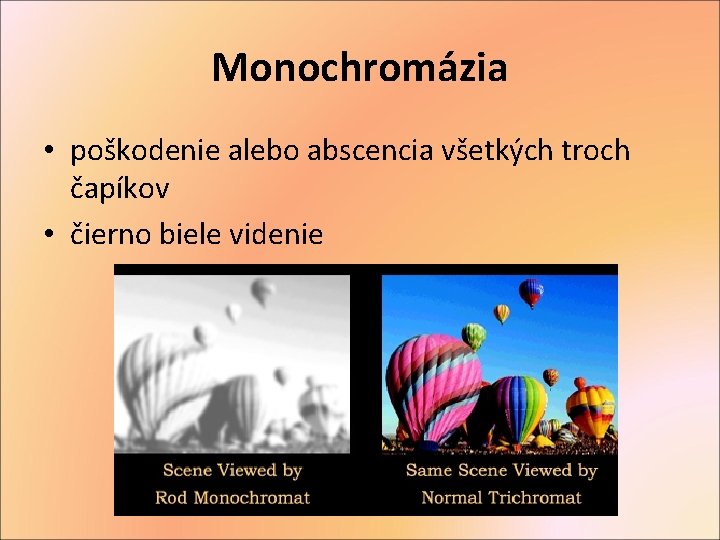 Monochromázia • poškodenie alebo abscencia všetkých troch čapíkov • čierno biele videnie 