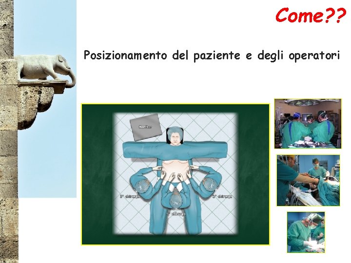 Come? ? Posizionamento del paziente e degli operatori 