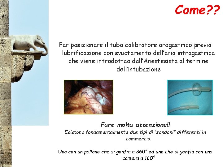 Come? ? Far posizionare il tubo calibratore orogastrico previa lubrificazione con svuotamento dell’aria intragastrica