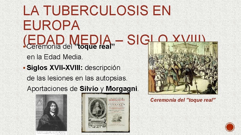 LA TUBERCULOSIS EN EUROPA (EDAD MEDIA – SIGLO XVIII) § Ceremonia del ”toque real”