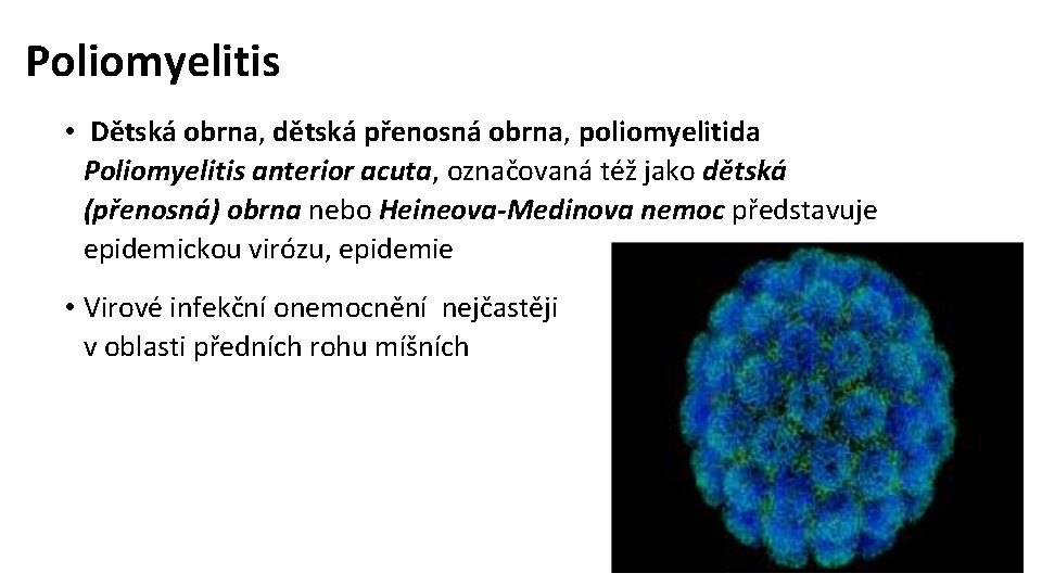 Poliomyelitis • Dětská obrna, dětská přenosná obrna, poliomyelitida Poliomyelitis anterior acuta, označovaná též jako