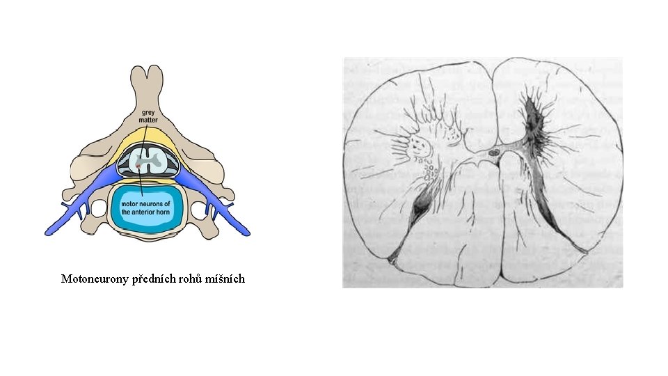 Motoneurony předních rohů míšních 