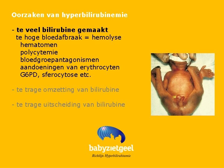 Oorzaken van hyperbilirubinemie - te veel bilirubine gemaakt te hoge bloedafbraak = hemolyse hematomen