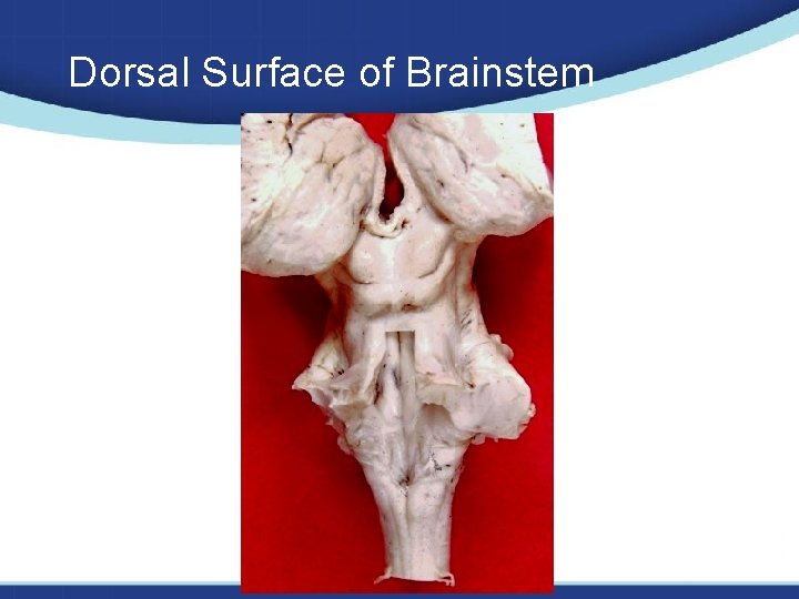 Dorsal Surface of Brainstem 