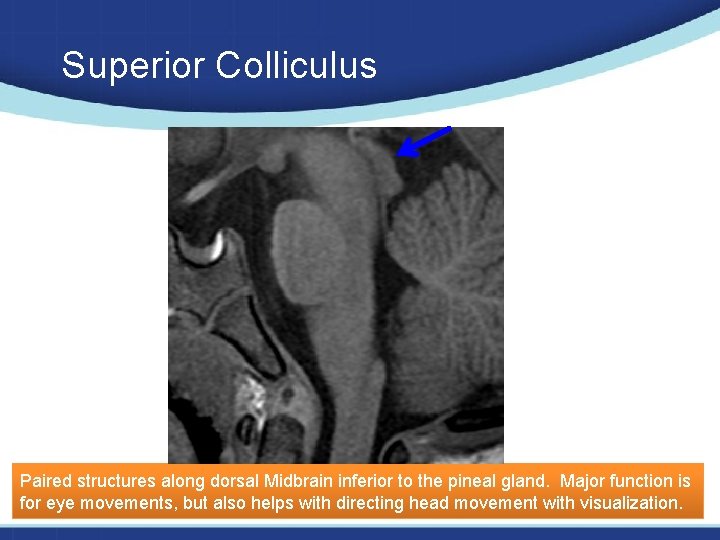 Superior Colliculus Paired structures along dorsal Midbrain inferior to the pineal gland. Major function