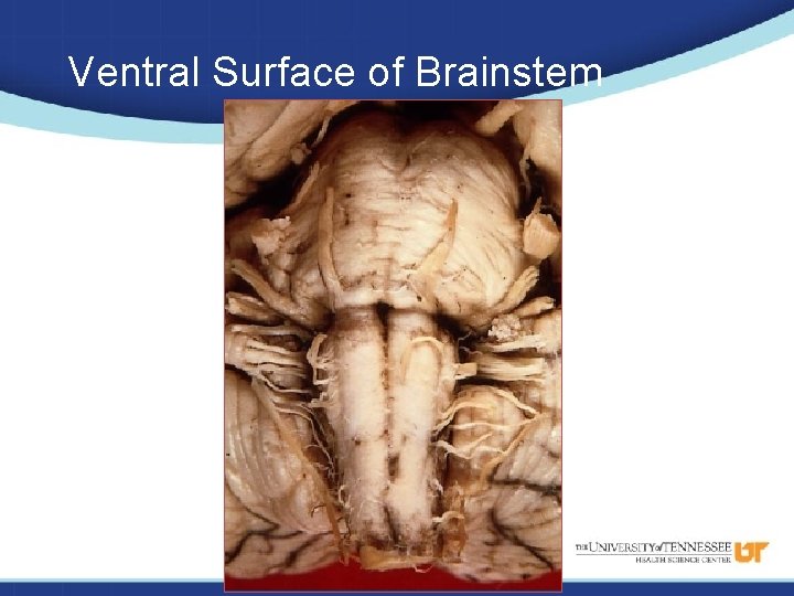 Ventral Surface of Brainstem 