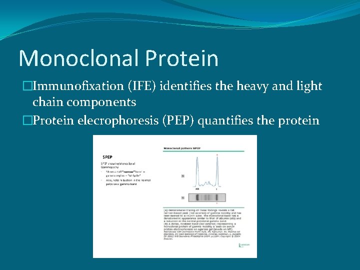 Monoclonal Protein �Immunofixation (IFE) identifies the heavy and light chain components �Protein elecrophoresis (PEP)