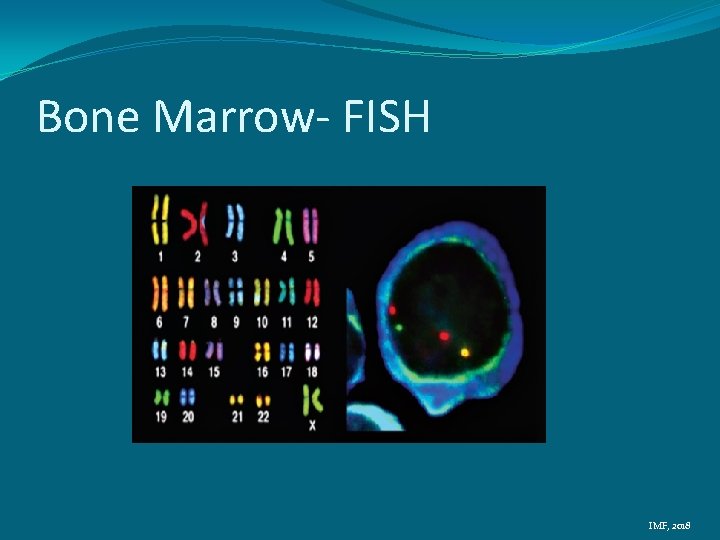 Bone Marrow- FISH IMF, 2018 