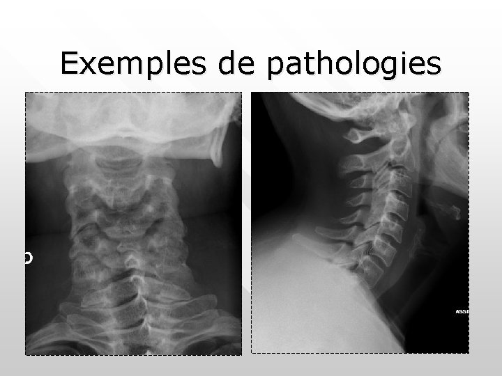 Exemples de pathologies 