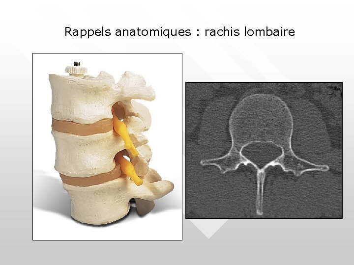 Rappels anatomiques : rachis lombaire 