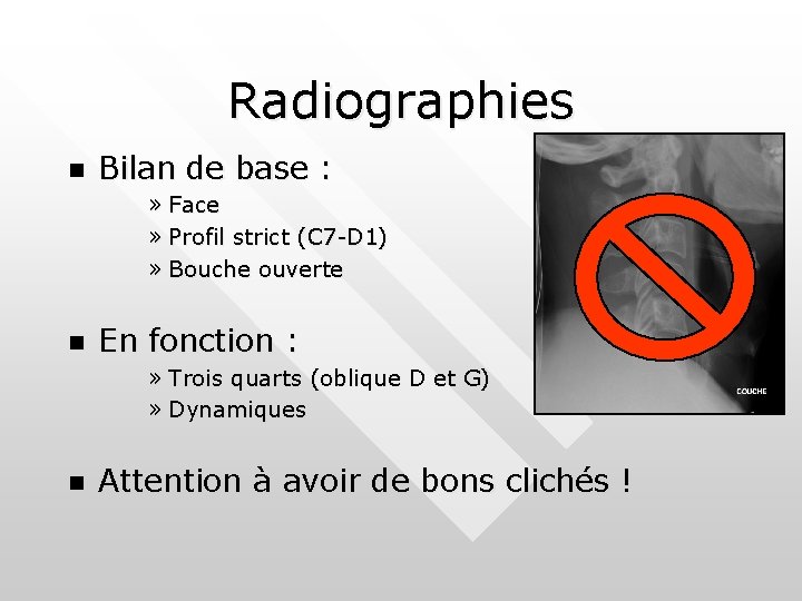 Radiographies n Bilan de base : » Face » Profil strict (C 7 -D