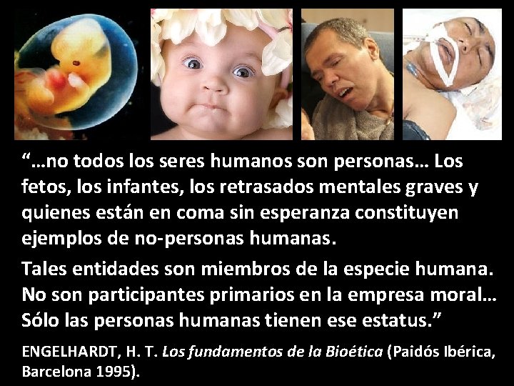 “…no todos los seres humanos son personas… Los fetos, los infantes, los retrasados mentales
