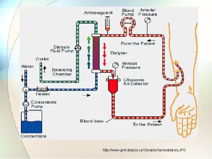 http: //www. gml-dialyza. cz/Obrazky/hemodialysis. JPG 