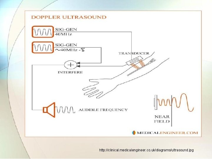 http: //clinical. medicalengineer. co. uk/diagrams/ultrasound. jpg 