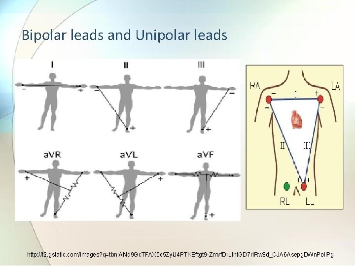 Bipolar leads and Unipolar leads http: //t 2. gstatic. com/images? q=tbn: ANd 9 Gc.