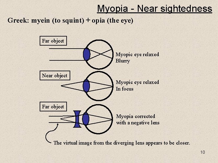 Myopia - Near sightedness Greek: myein (to squint) + opia (the eye) Far object