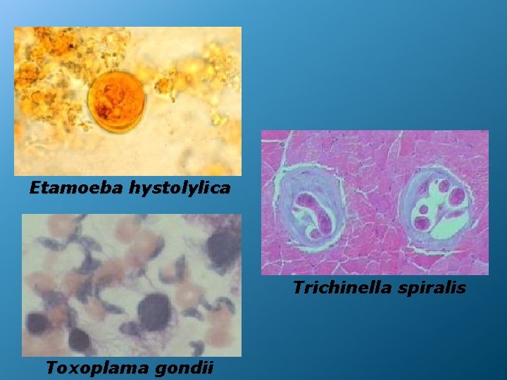 Etamoeba hystolylica Trichinella spiralis Toxoplama gondii 