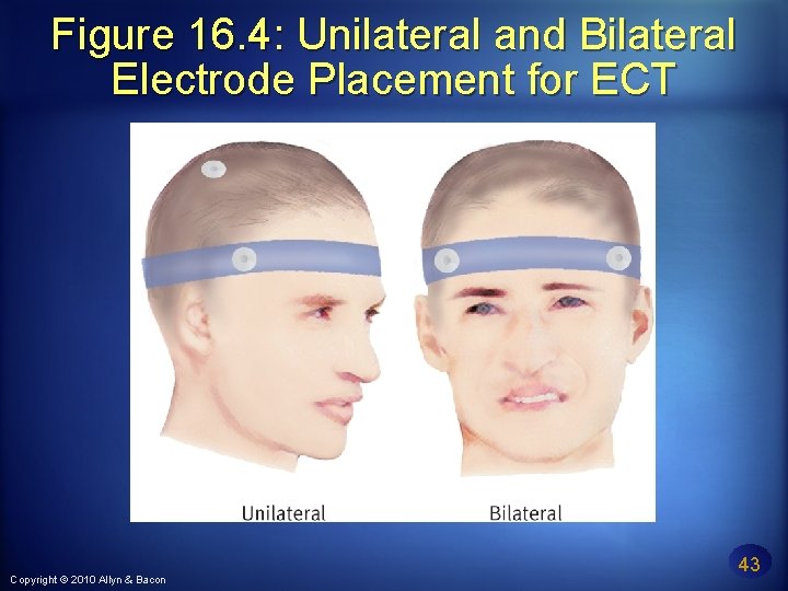 Figure 16. 4: Unilateral and Bilateral Electrode Placement for ECT Copyright © 2010 Allyn