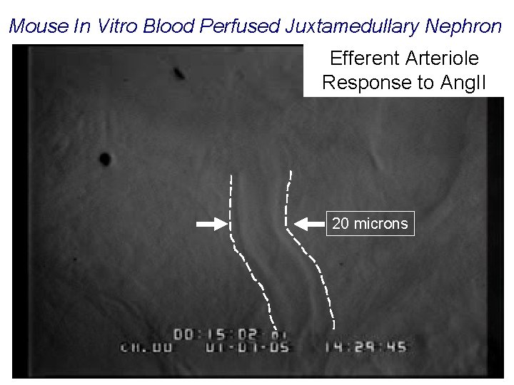 Mouse In Vitro Blood Perfused Juxtamedullary Nephron Efferent Arteriole Response to Ang. II 20
