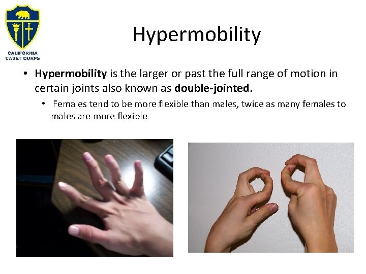 Hypermobility • Hypermobility is the larger or past the full range of motion in