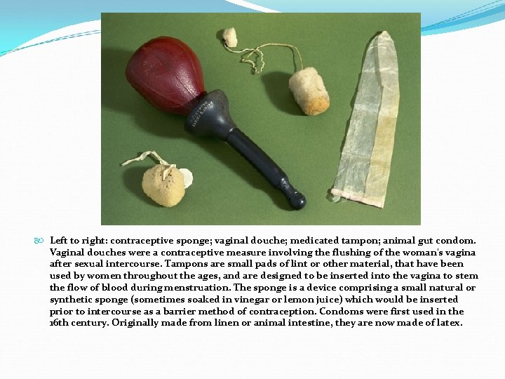  Left to right: contraceptive sponge; vaginal douche; medicated tampon; animal gut condom. Vaginal