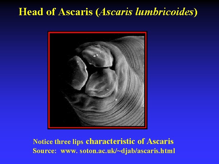Head of Ascaris (Ascaris lumbricoides) Notice three lips characteristic of Ascaris Source: www. soton.