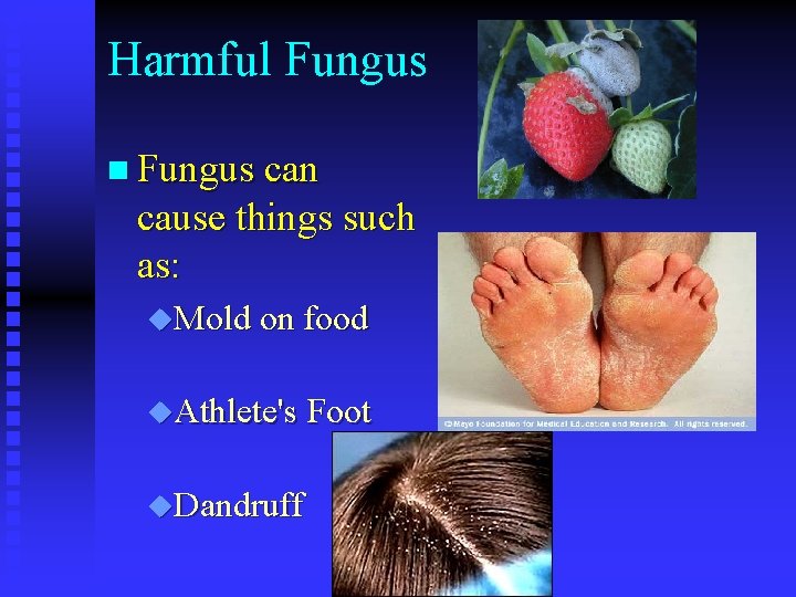 Harmful Fungus n Fungus can cause things such as: u. Mold on food u.