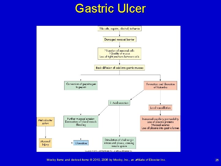 Gastric Ulcer Mosby items and derived items © 2010, 2006 by Mosby, Inc. ,