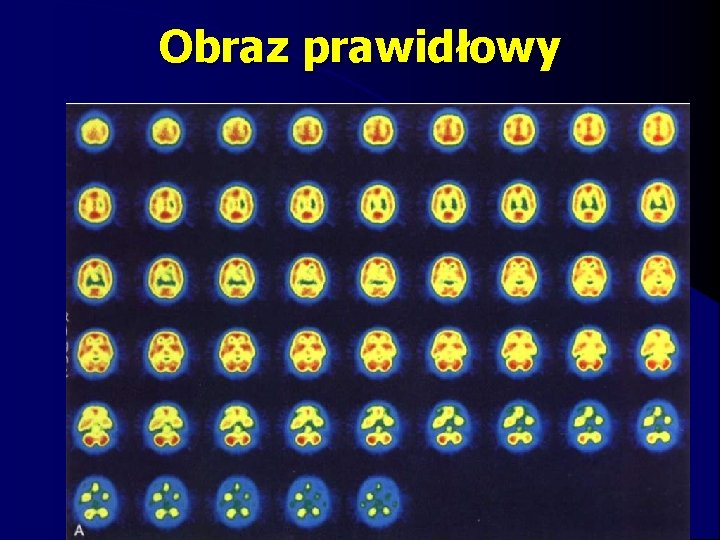 Obraz prawidłowy 