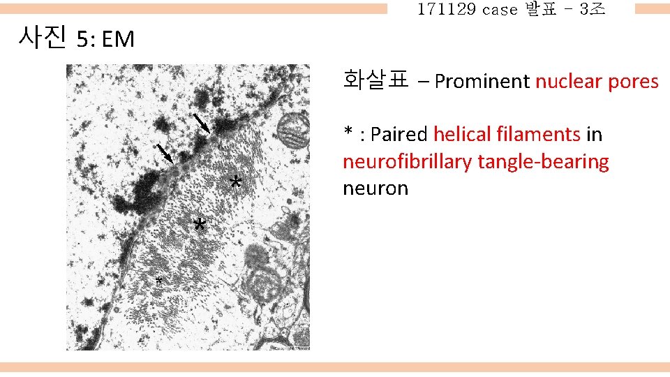 171129 case 발표 - 3조 사진 5: EM 화살표 – Prominent nuclear pores *