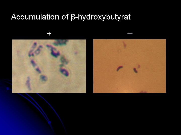 Accumulation of β-hydroxybutyrat + － 