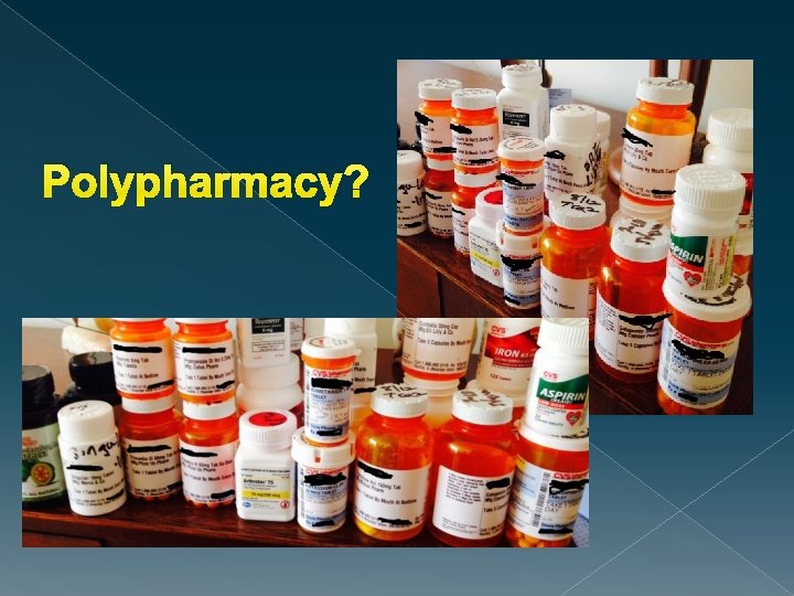 Polypharmacy? 