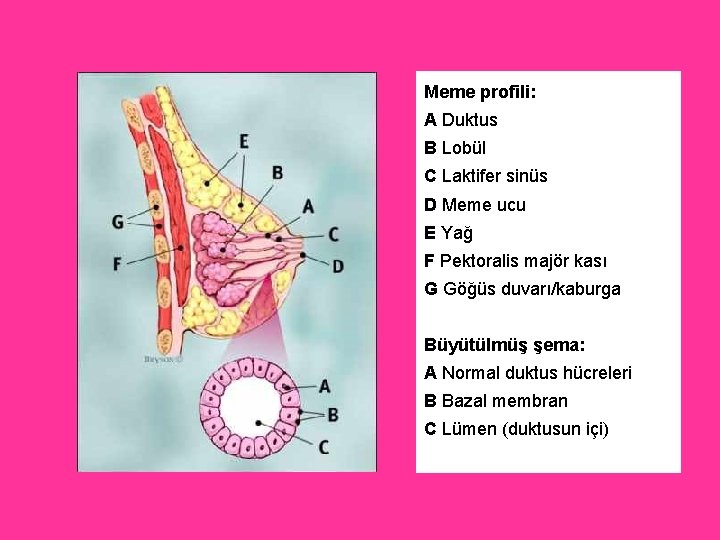 Meme profili: A Duktus B Lobül C Laktifer sinüs D Meme ucu E Yağ