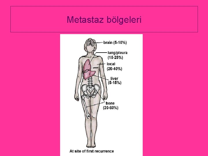 Metastaz bölgeleri 