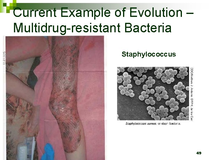 Current Example of Evolution – Multidrug-resistant Bacteria Evolved. R to Penicillin obtained from a