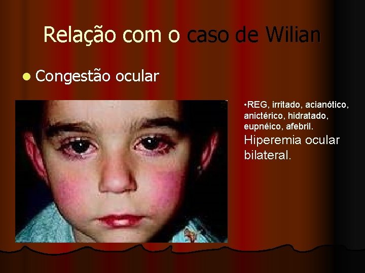 Relação com o caso de Wilian l Congestão ocular • REG, irritado, acianótico, anictérico,