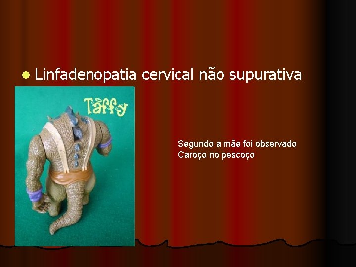 l Linfadenopatia cervical não supurativa Segundo a mãe foi observado Caroço no pescoço 