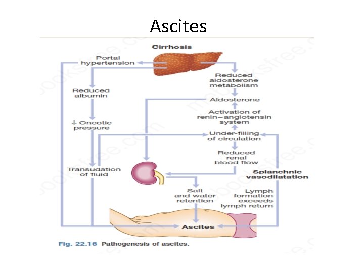 Ascites 