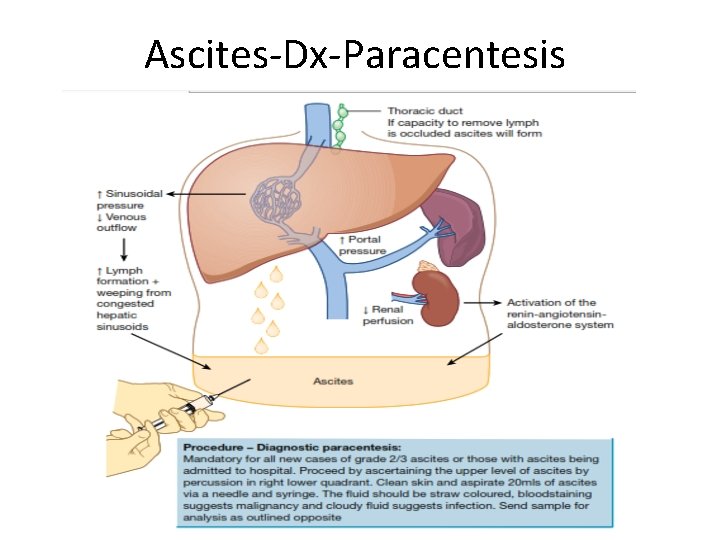 Ascites-Dx-Paracentesis 