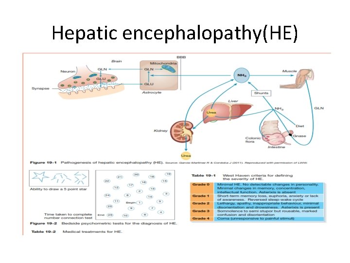 Hepatic encephalopathy(HE) 