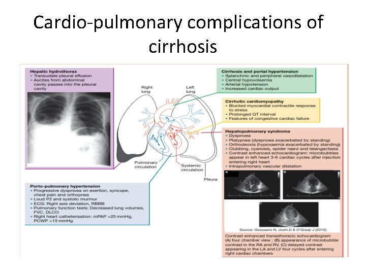 Cardio-pulmonary complications of cirrhosis 