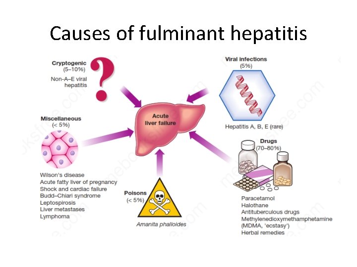 Causes of fulminant hepatitis 