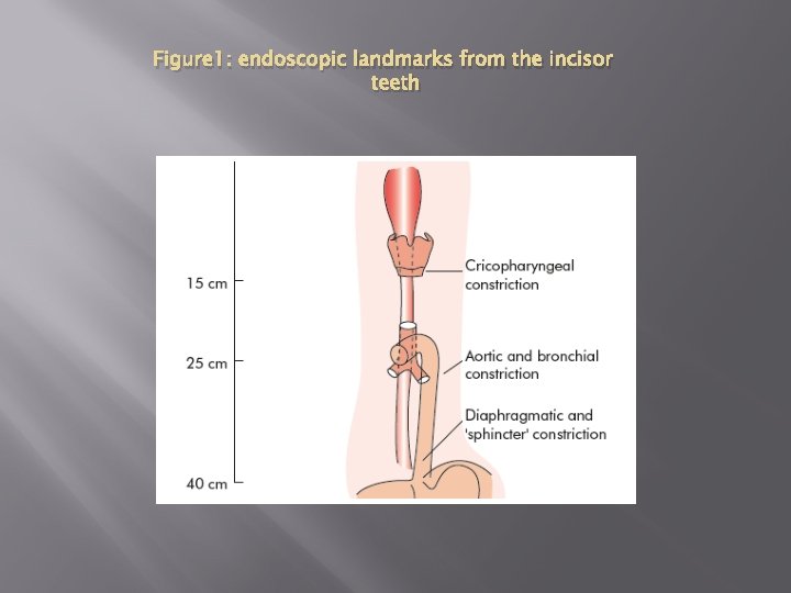 Figure 1: endoscopic landmarks from the incisor teeth 