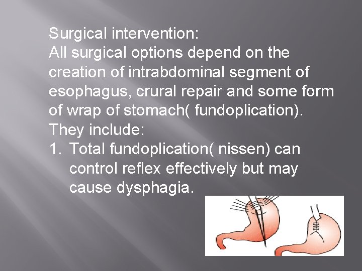 Surgical intervention: All surgical options depend on the creation of intrabdominal segment of esophagus,