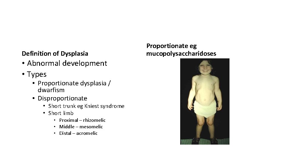 Definition of Dysplasia • Abnormal development • Types • Proportionate dysplasia / dwarfism •