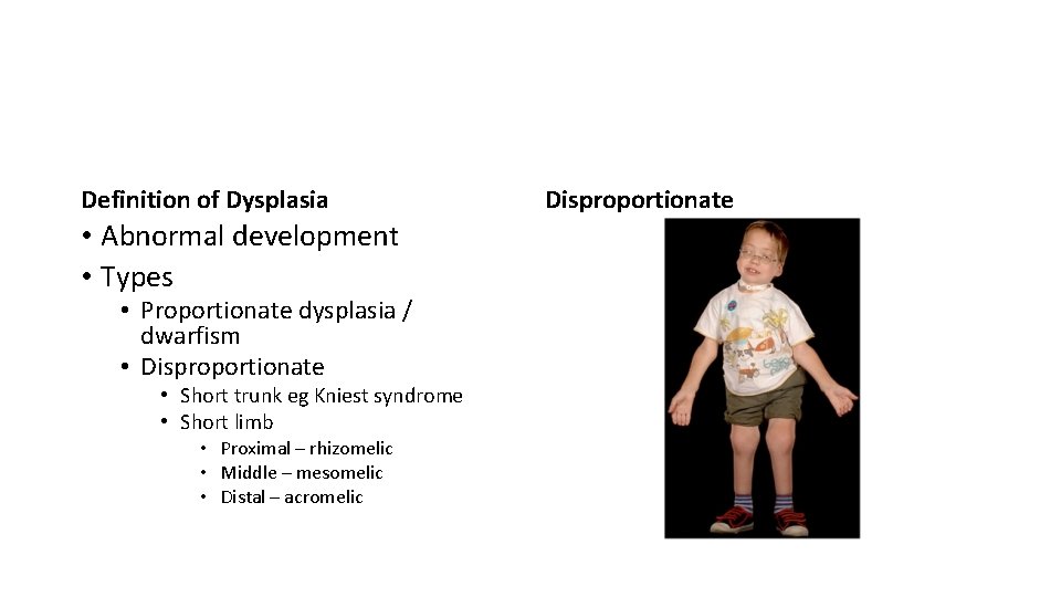 Definition of Dysplasia • Abnormal development • Types • Proportionate dysplasia / dwarfism •