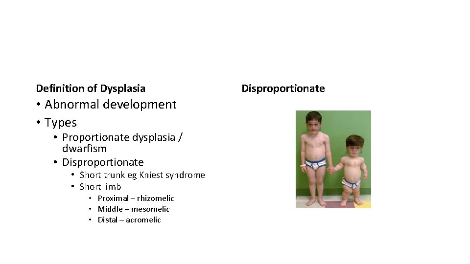 Definition of Dysplasia • Abnormal development • Types • Proportionate dysplasia / dwarfism •